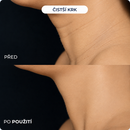 Zbavte se známek stárnutí z pohodlí domova za pouhých 5 minut